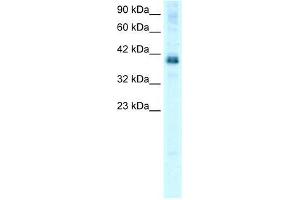 Human HepG2; WB Suggested Anti-TSC22D4 Antibody Titration: 0. (TSC22D4 anticorps  (N-Term))