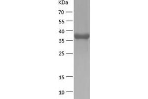 Western Blotting (WB) image for RD RNA Binding Protein (RDBP) (AA 1-380) protein (His tag) (ABIN7124797) (RDBP Protein (AA 1-380) (His tag))