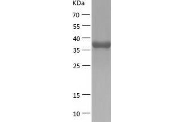 RDBP Protein (AA 1-380) (His tag)