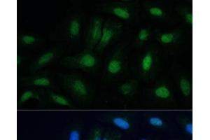 Immunofluorescence analysis of U-2 OS cells using ETS2 Polyclonal Antibody at dilution of 1:100. (ETS2 anticorps)