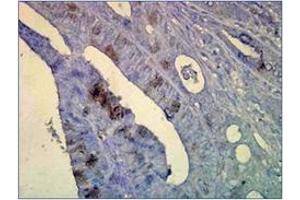 Immunohistochemistry (IHC) image for anti-Heat Shock Protein 70 (HSP70) antibody (ABIN263937) (HSP70 anticorps)