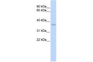 WB Suggested Anti-SFXN3 Antibody Titration:  0. (SFXN3 anticorps  (Middle Region))