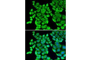 Immunofluorescence analysis of U20S cell using EEF1D antibody. (EEF1D anticorps  (AA 1-160))