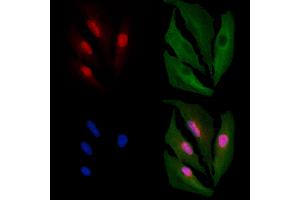 ABIN6261411 and ABIN6266531 staining  cells by IF/ICC.