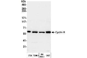 Western Blotting (WB) image for anti-Cyclin K (CCNK) (AA 530-580) antibody (ABIN7453581) (Cyclin K anticorps  (AA 530-580))
