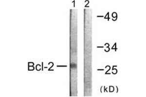 Western blot analysis of extracts from K562 cells, using BCL-2 (Ab-69) Antibody. (Bcl-2 anticorps  (AA 46-95))