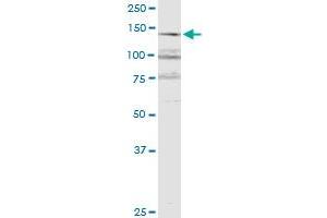 RERE monoclonal antibody (M06), clone 2F2.