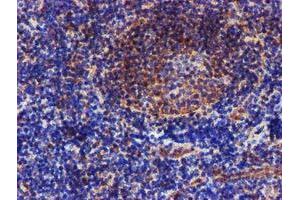 Image no. 5 for anti-Epsin 2 (EPN2) antibody (ABIN1498050)