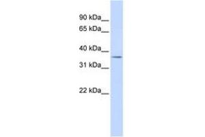 Image no. 1 for anti-Tripartite Motif Containing 69 (TRIM69) (AA 36-85) antibody (ABIN6742519) (TRIM69 anticorps  (AA 36-85))