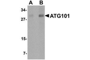 Western blot analysis of ATG101 in human liver tissue lysate with ATG101 antibody at (A) 1 and (B) 2 μg/ml. (ATG101 anticorps  (Center))