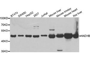Western blot analysis of extracts of various cell lines, using HADHB antibody. (HADHB anticorps)