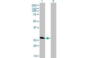 Western Blotting (WB) image for anti-Ring Finger Protein 114 (RNF114) (AA 1-229) antibody (ABIN466223) (RNF114 anticorps  (AA 1-229))