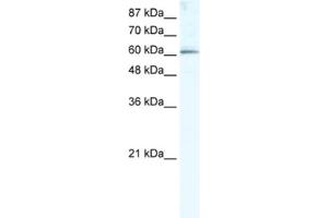 Western Blotting (WB) image for anti-Methyltransferase Like 3 (METTL3) antibody (ABIN2460997) (METTL3 anticorps)