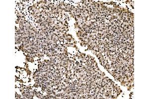 IHC analysis of SPHK1 using anti-SPHK1 antibody (ABIN7600168).