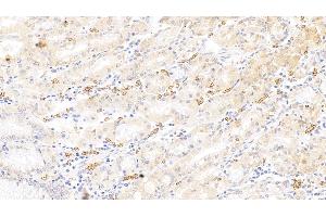 Detection of GYPA in Human Stomach Tissue using Polyclonal Antibody to Glycophorin A (GYPA) (CD235a/GYPA anticorps  (AA 20-91))