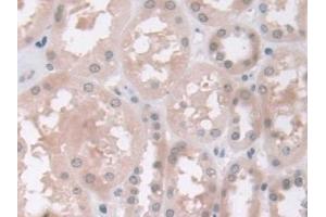 Detection of GAMT in Human Kidney Tissue using Polyclonal Antibody to Guanidinoacetate-N-Methyltransferase (GAMT)