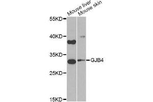 Western blot analysis of extracts of various cell lines, using GJB4 Antibody (ABIN6003620) at 1/1000 dilution.