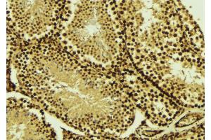 ABIN6269020 at 1/100 staining Mouse testis tissue by IHC-P. (TBP anticorps  (N-Term))