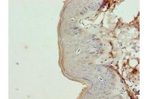 Immunohistochemistry of paraffin-embedded human skin tissue using ABIN7157364 at dilution of 1:100