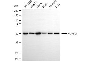 Western blotting analysis using RUVBL1 antibody (ABIN7800967).