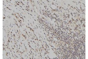 ABIN6261071 and ABIN6277699 at 1/100 staining Human gastric tissue by IHC-P.