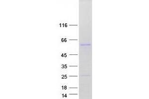 Validation with Western Blot