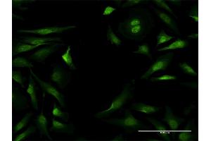 Immunofluorescence of purified MaxPab antibody to NLK on HeLa cell. (Nemo-Like Kinase anticorps  (AA 1-515))