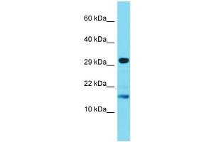 Host: Rabbit Target Name: TREML4 Sample Type: Jurkat Whole Cell lysates Antibody Dilution: 1.