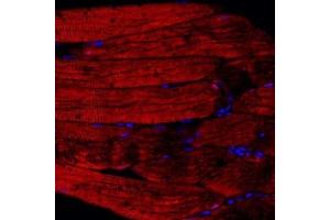 Immunofluorescent analysis of paraffin embedded rat skeletal muscle using PPP2R2C (ABIN7075278) at dilution of 1: 500