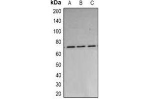 Western blot analysis of PARN expression in A549 (A), MCF7 (B), HepG2 (C) whole cell lysates. (PARN anticorps)