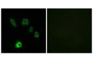 Immunofluorescence analysis of HuvEc cells, using FGF18 antibody.