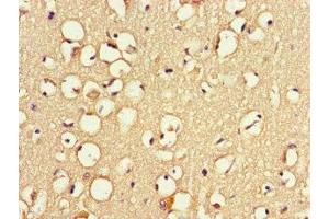 Immunohistochemistry of paraffin-embedded human brain tissue using ABIN7166372 at dilution of 1:100