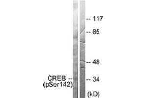 Western blot analysis of extracts from HeLa cells treated with PMA 125ng/ml 30', using CREB (Phospho-Ser142) Antibody. (CREB1 anticorps  (pSer142))