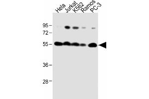 All lanes : Anti-CALR Antibody (Center) at 1:1000 dilution Lane 1: Hela whole cell lysate Lane 2:Jurkat whole cell lysate Lane 3: K562 whole cell lysate Lane 4: Ramos whole cell lysate Lane 5: PC-3 whole cell lysate Lysates/proteins at 20 μg per lane.