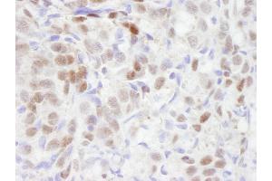 Immunohistochemistry (IHC) image for anti-Transducin (Beta)-Like 1 X-Linked Receptor 1 (TBL1XR1) (AA 100-150) antibody (ABIN7448826) (TBL1XR1 anticorps  (AA 100-150))