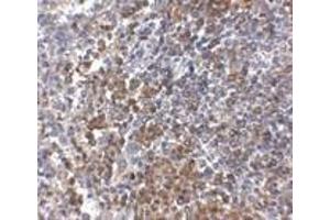 Immunohistochemistry of GPR3 in human spleen tissue with GPR3 antibody at 2.