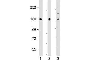 Western blot testing of human 1) U-87 MG, 2) HeLa and 3) BxPC-3 cell lysate with MGEA5 antibody at 1:2000. (MGEA5 anticorps  (AA 236-269))