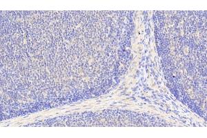 Detection of BCAT1 in Human Lymph node Tissue using Polyclonal Antibody to Branched Chain Aminotransferase 1, Cytosolic (BCAT1) (BCAT1 anticorps  (AA 174-386))