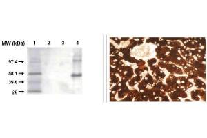 Immunohistochemistry (IHC) image for anti-Cytochrome P450, Family 1, Subfamily A, Polypeptide 2 (CYP1A2) antibody (ABIN264499) (CYP1A2 anticorps)