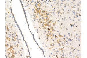 ABIN6257472 and ABIN6274755 at 1/100 staining Mouse brain tissue by IHC-P.