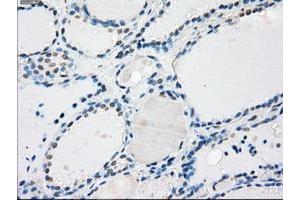 Image no. 3 for anti-Protein Phosphatase 5, Catalytic Subunit (PPP5C) antibody (ABIN1500390)