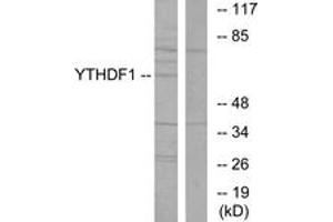 Western blot analysis of extracts from 293 cells, using YTHDF1 Antibody. (YTHDF1 anticorps  (AA 1-50))