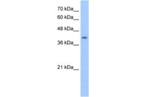 Western Blotting (WB) image for anti-ACC Synthase-Like Protein 1 (ACCS) antibody (ABIN2463243) (PHACS anticorps)