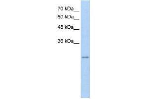 WB Suggested Anti-RFPL3 Antibody Titration:  5.