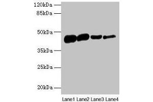 Western blot All lanes: ACTA1 antibody at 16 μg/mL Lane 1: Rat heart tissue Lane 2: Mouse skeletal muscle tissue Lane 3: Human placenta tissue Lane 4: CEM whole cell lysate Secondary Goat polyclonal to rabbit IgG at 1/10000 dilution Predicted band size: 43 kDa Observed band size: 43 kDa (Actin anticorps  (AA 3-377))