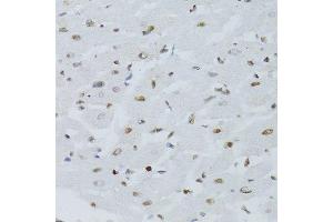 Immunohistochemistry of paraffin-embedded mouse heart using NFKB2 Antibody.