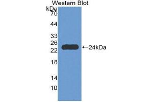 Western Blotting (WB) image for anti-Tumor Necrosis Factor Receptor Superfamily, Member 1A (TNFRSF1A) (AA 248-428) antibody (ABIN1980533) (TNFRSF1A anticorps  (AA 248-428))