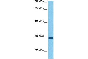 Host:  Rabbit  Target Name:  SNAI1  Sample Tissue:  Human Stomach Tumor  Antibody Dilution:  1ug/ml