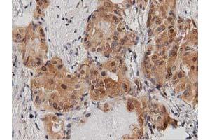Immunohistochemical staining of paraffin-embedded Human Kidney tissue using anti-DNAJA2 mouse monoclonal antibody. (DNAJA2 anticorps)
