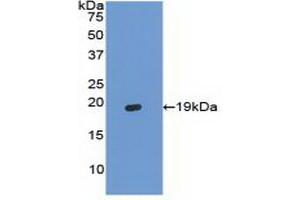 Detection of Recombinant HBa1, Bovine using Polyclonal Antibody to Hemoglobin Alpha 1 (HBa1) (HBA1 anticorps  (AA 2-142))